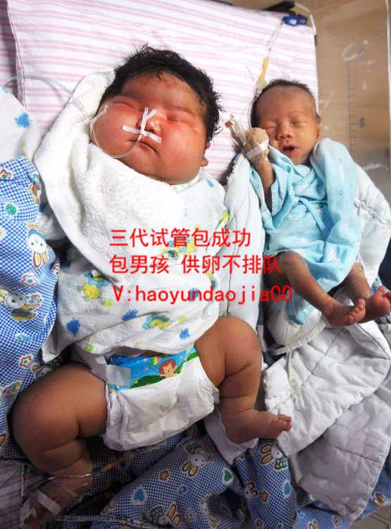 北京医院可以供卵吗_北京山大生殖医院供卵试管_生活方式改善如何改善卵母细